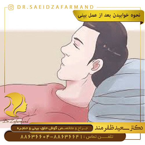 نحوه-خوابیدن-بعد-از-عمل-بینی