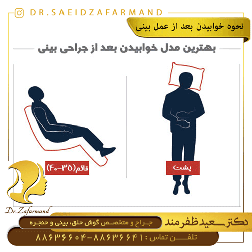 نحوه-صحیح-خوابیدن-بعد-از-جراحی-بینی