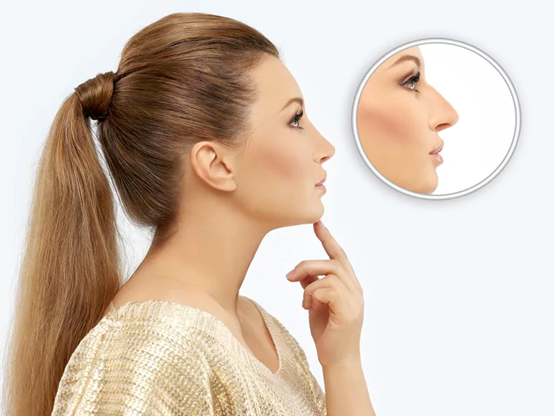 کاندید مناسب جراحی بینی