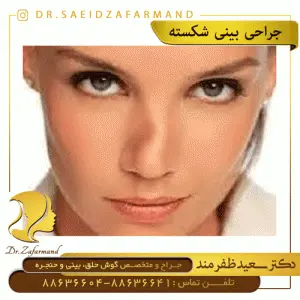 جراحی بینی شکسته