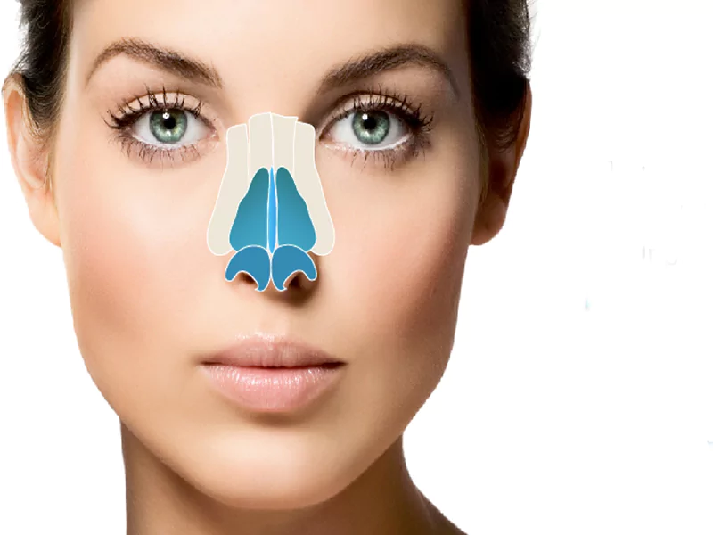 پیوند غضروف در عمل بینی