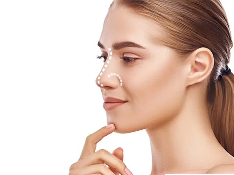 چندبار می‌توان عمل بینی انجام داد