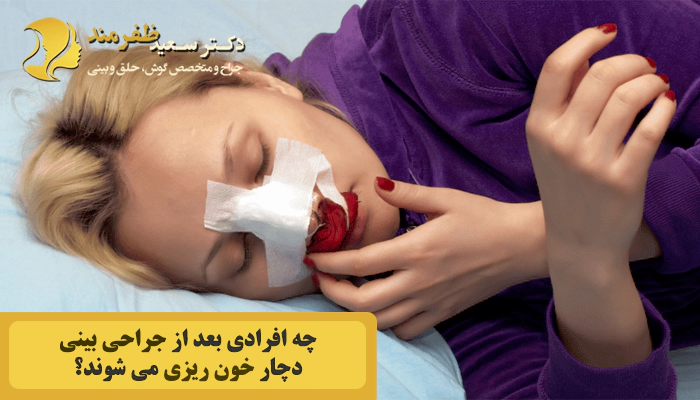 چه کسانی بعد از جراحی بینی دچار خون ریزی می شوند؟