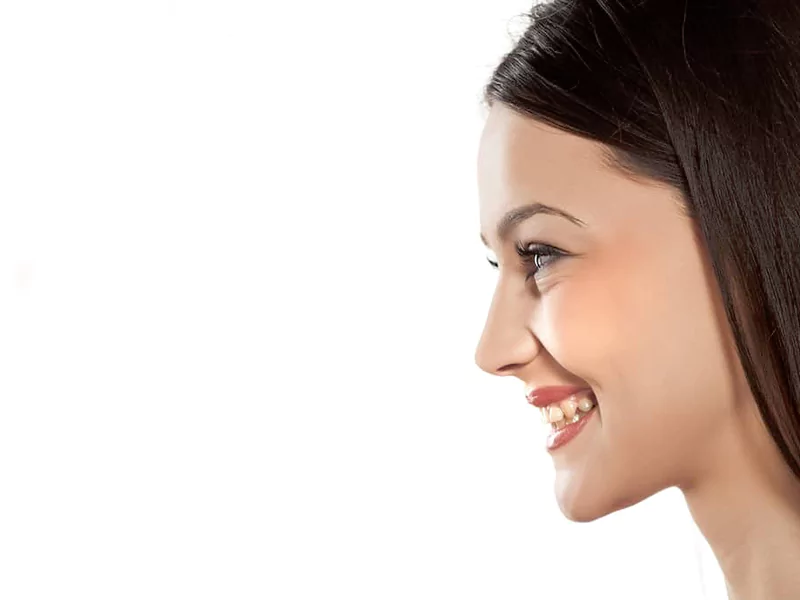 عوارض خندیدن بعد از عمل بینی