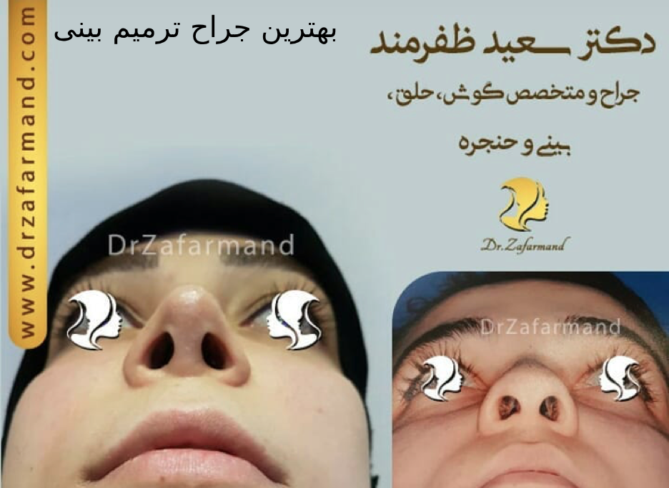 بهترین جراح ترمیم بینی