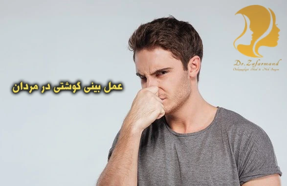 عمل بینی گوشتی در مردان