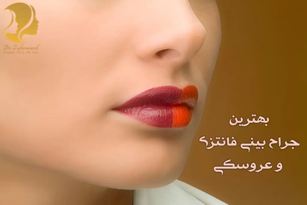 بهترین جراح بینی فانتزی در تهران