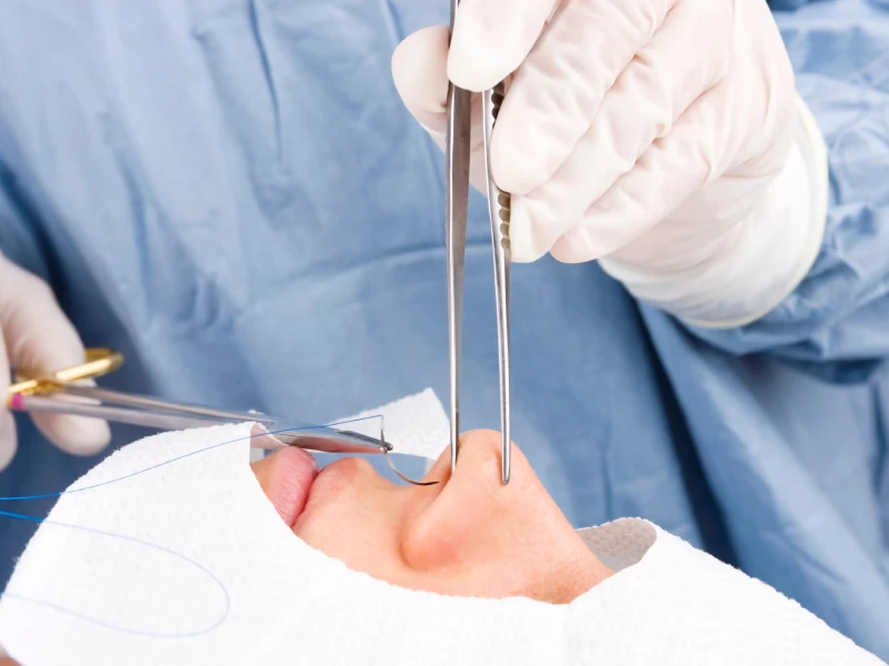 جراحی بینی بسته