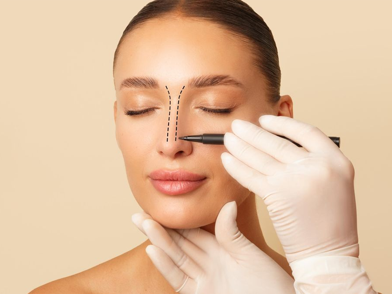 هزینه های عمل بینی در سال 1404